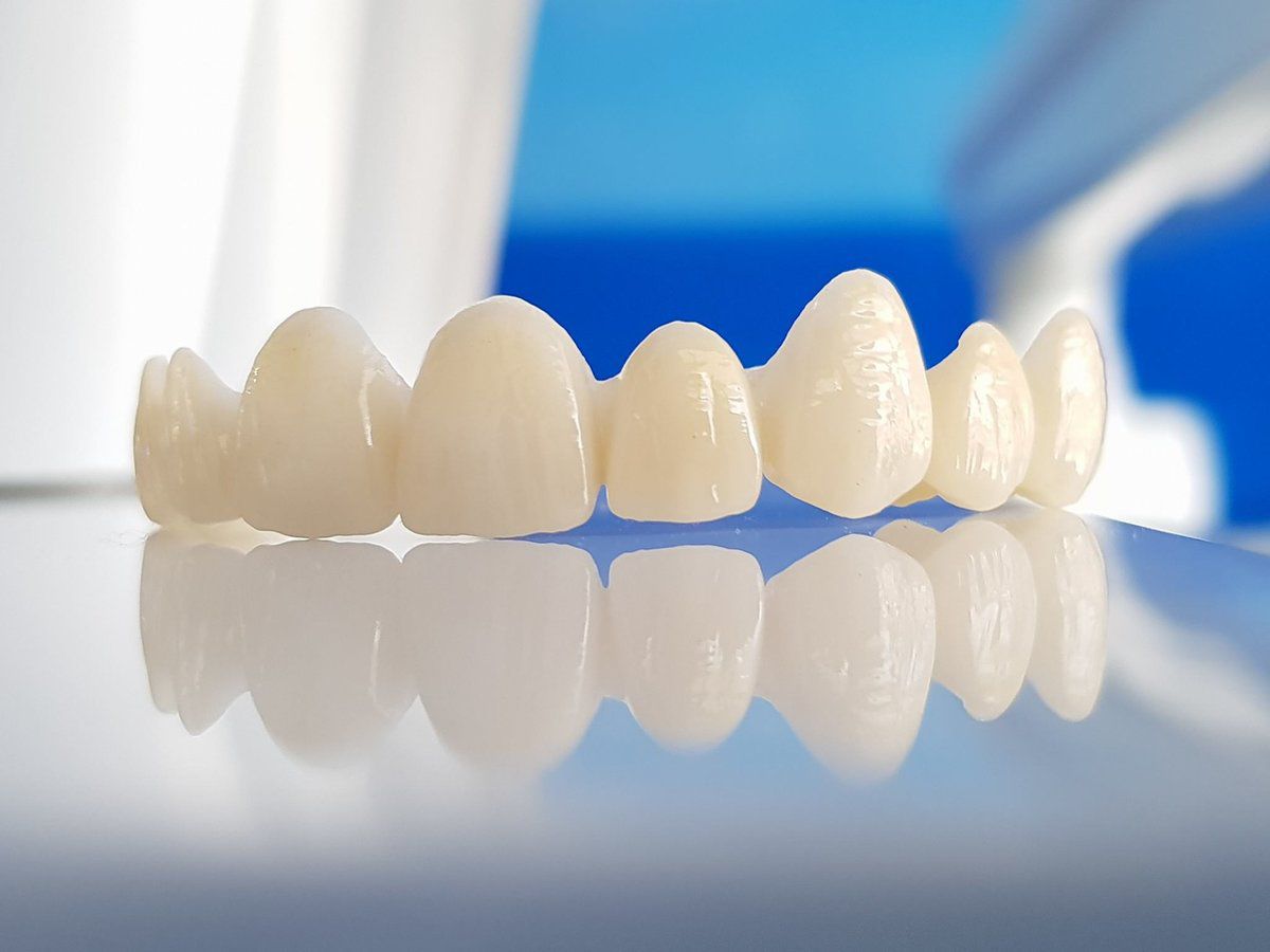 Rehabilitación Oral