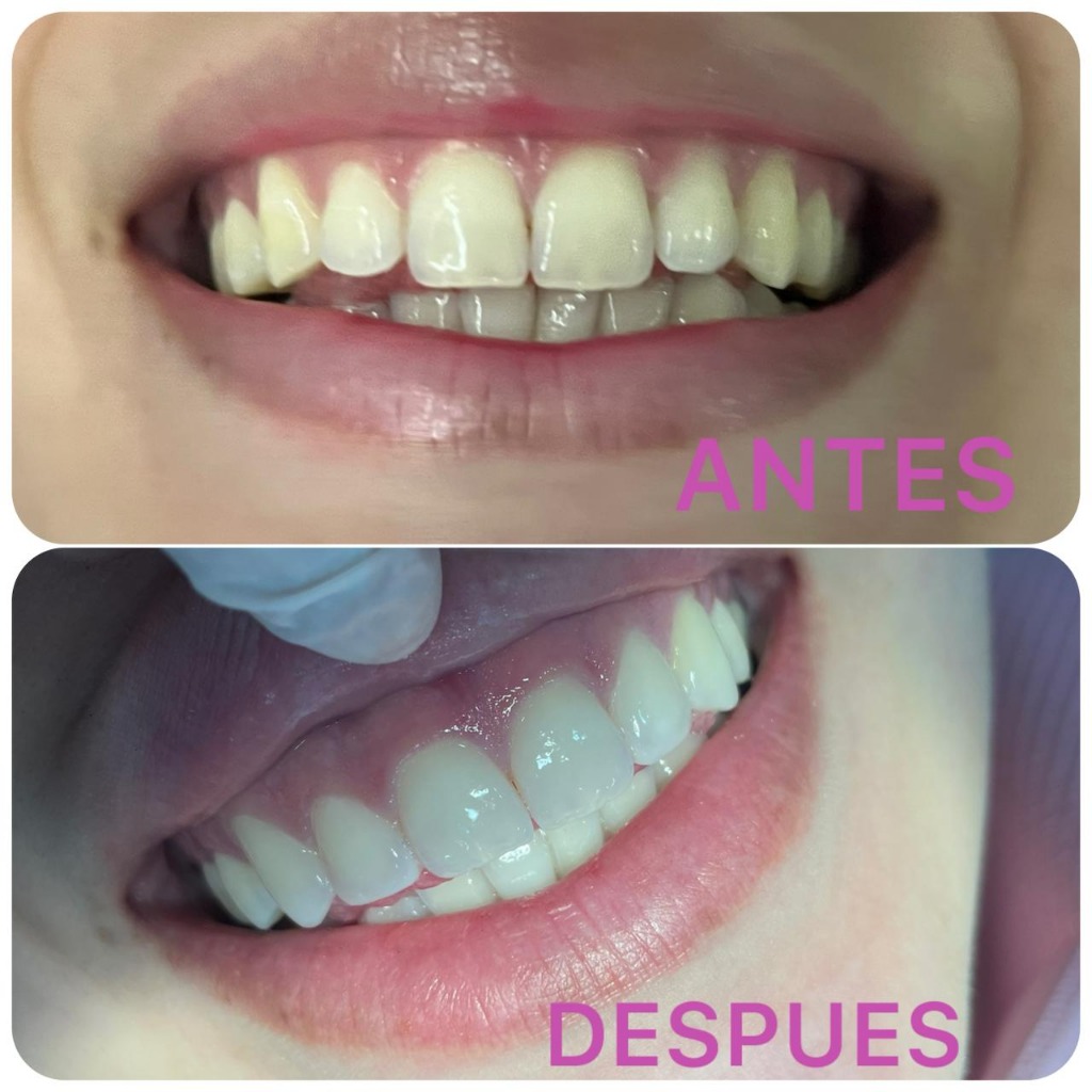 Caso Real 2 - Antes y Después