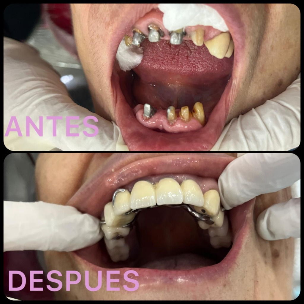 Caso Real 3 - Antes y Después